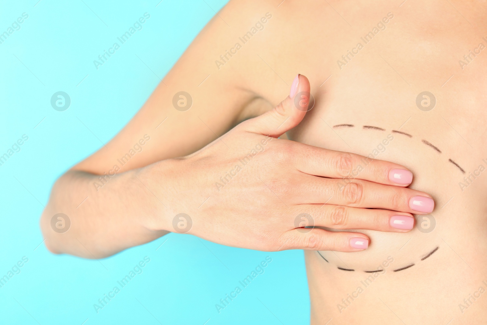 Photo of Young woman with marks on breast for cosmetic surgery operation against color background, closeup