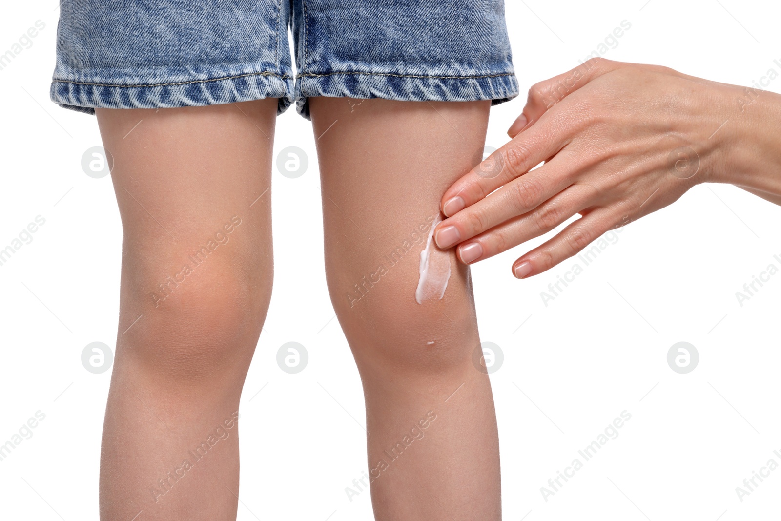 Photo of Mother applying ointment onto her daughter's knee on white background, closeup