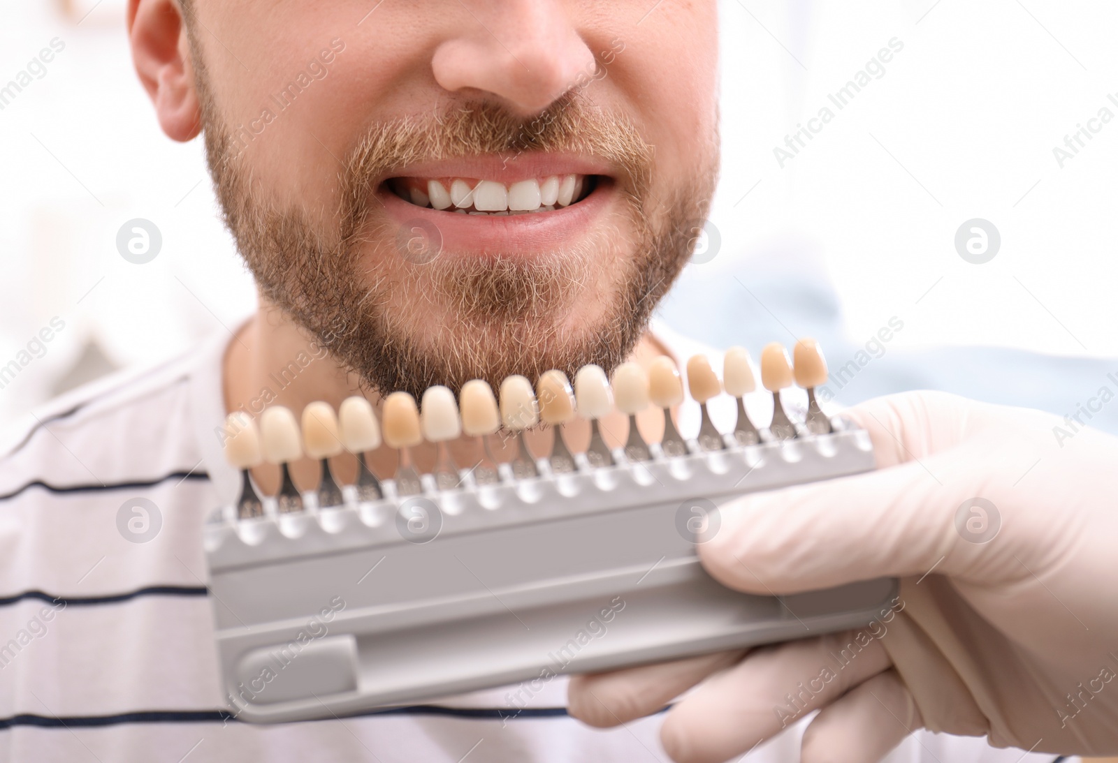 Photo of Dentist checking young man's teeth color, closeup