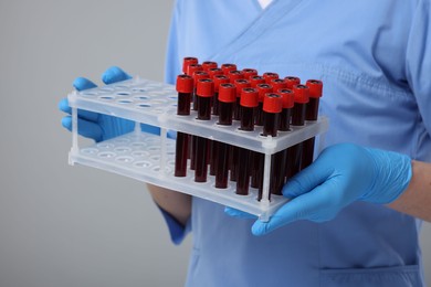 Laboratory testing. Doctor with blood samples in tubes on light grey background