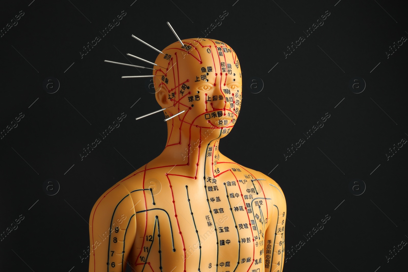 Photo of Acupuncture - alternative medicine. Human model with needles in head on black background