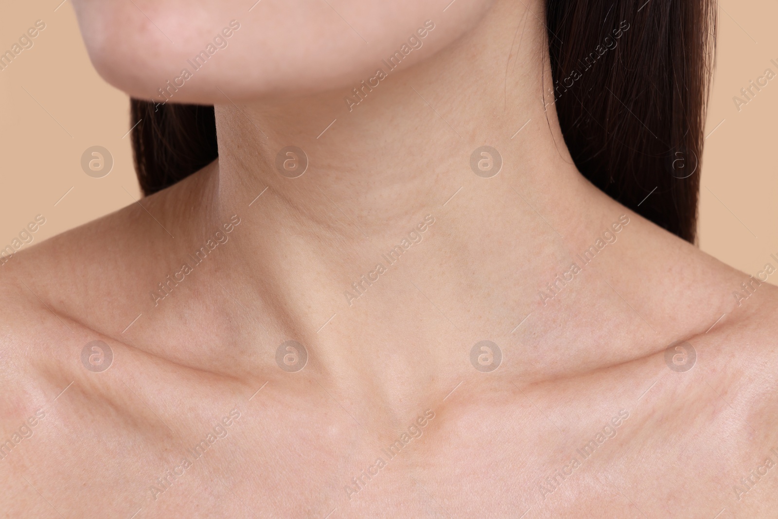 Photo of Closeup view of woman with healthy skin on beige background