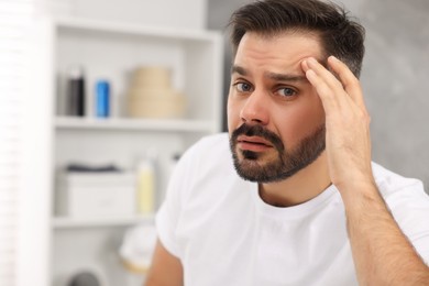 Photo of Skin problem. Confused man touching his face at home, space for text