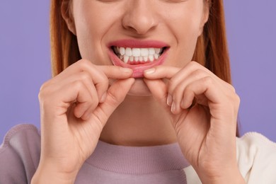 Woman showing her clean teeth on violet background, closeup