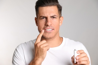 Photo of Man with herpes applying cream on lips against light grey background
