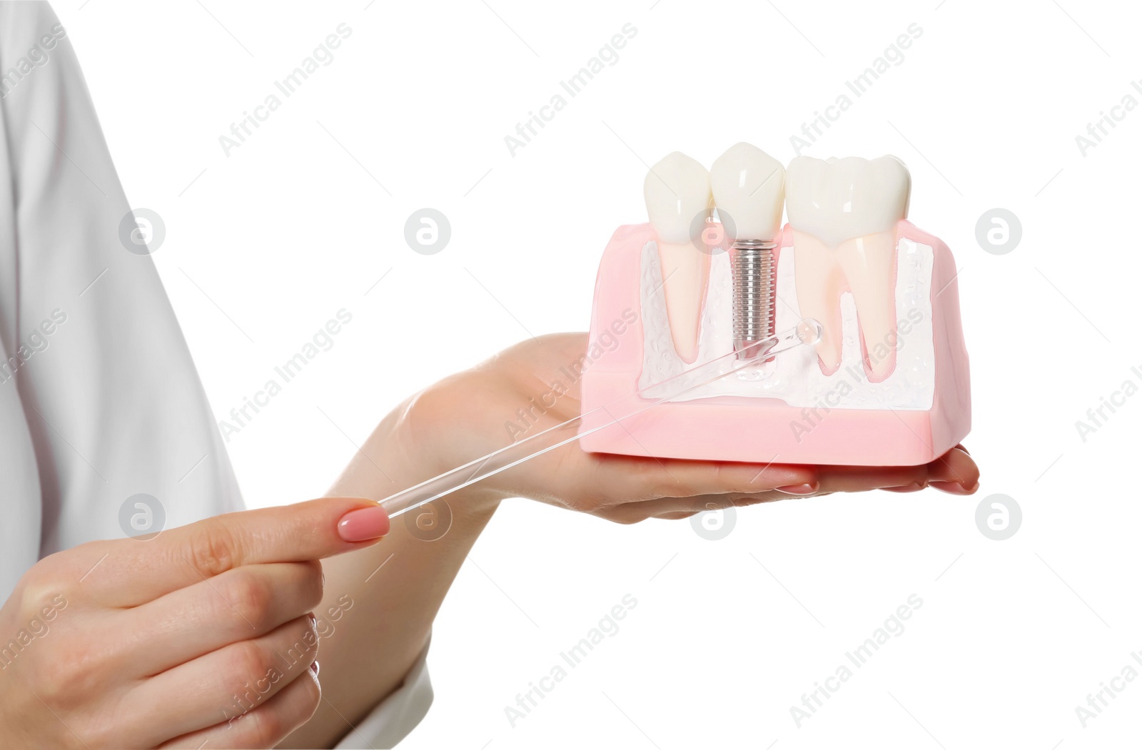 Photo of Dentist holding educational model of dental implant on white background, closeup