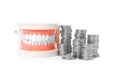 Photo of Educational dental typodont model and coins on white background. Expensive treatment