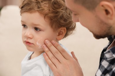 Photo of Father applying ointment onto his son`s cheek