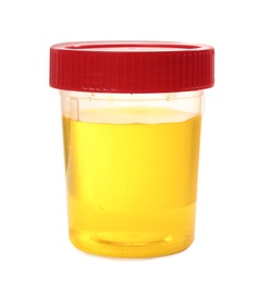 Photo of Container with urine sample for laboratory analysis on white background