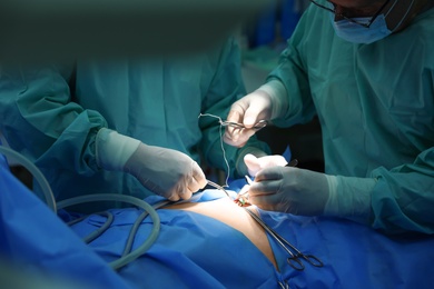 Photo of Medical team performing surgery in operating room, closeup