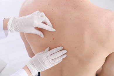 Doctor examining patient in clinic, closeup view. Visiting dermatologist