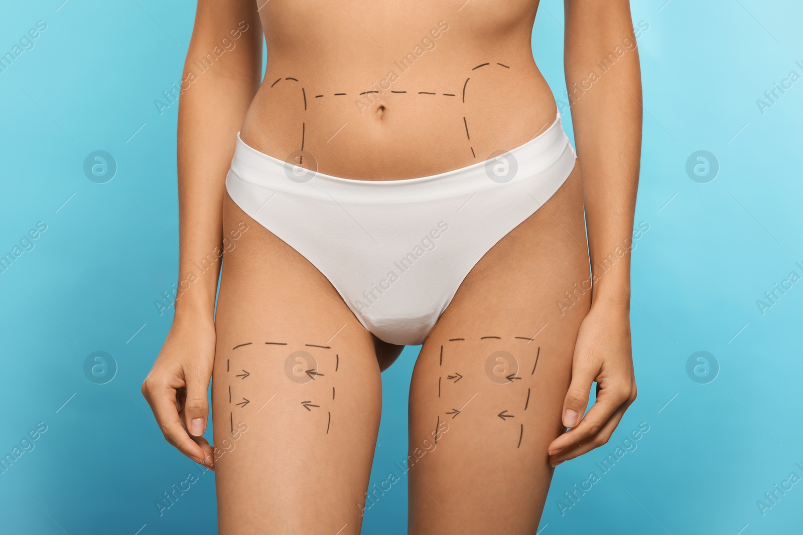 Photo of Slim woman with markings on body before cosmetic surgery operation on light blue background, closeup
