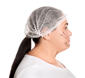 Photo of Woman with double chin ready for cosmetic surgery operation on white background