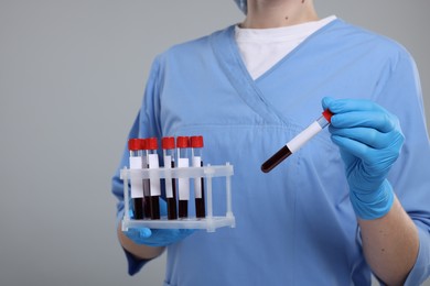 Photo of Laboratory testing. Doctor with blood samples in tubes on light grey background