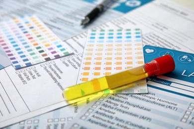 Test tube with urine sample for analysis on laboratory test form