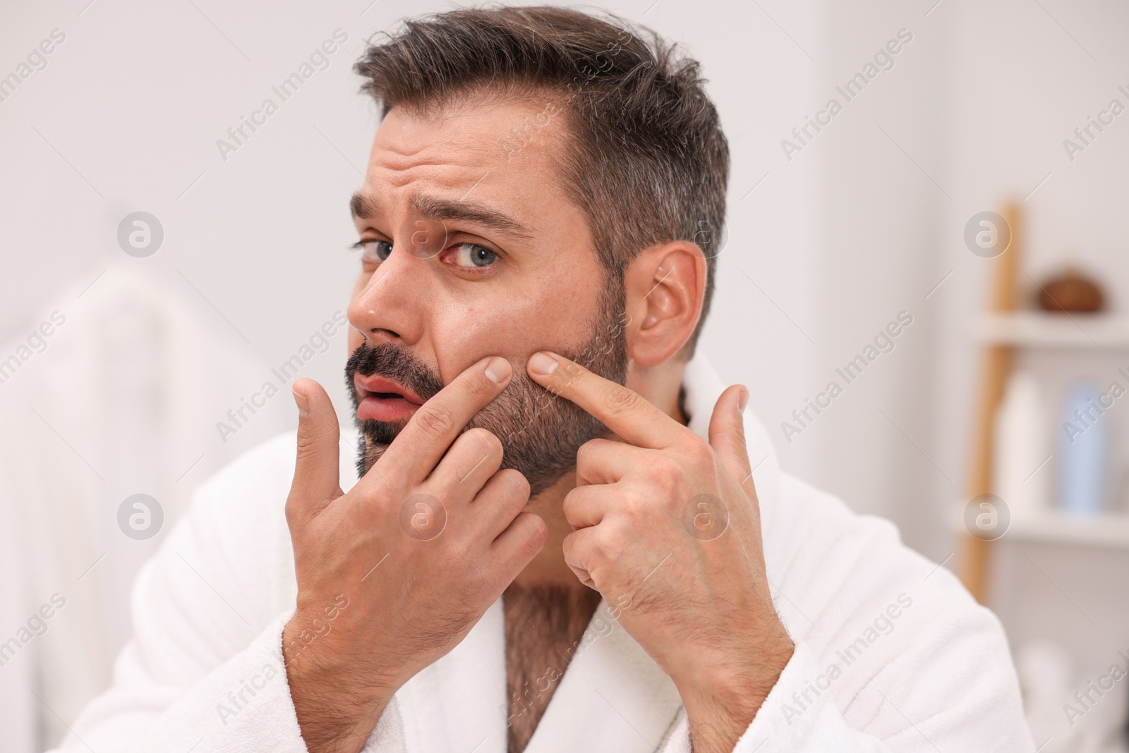 Photo of Skin problem. Confused man touching his face at home