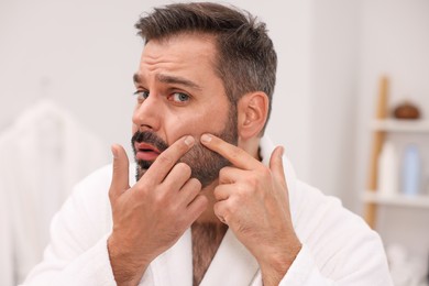 Photo of Skin problem. Confused man touching his face at home