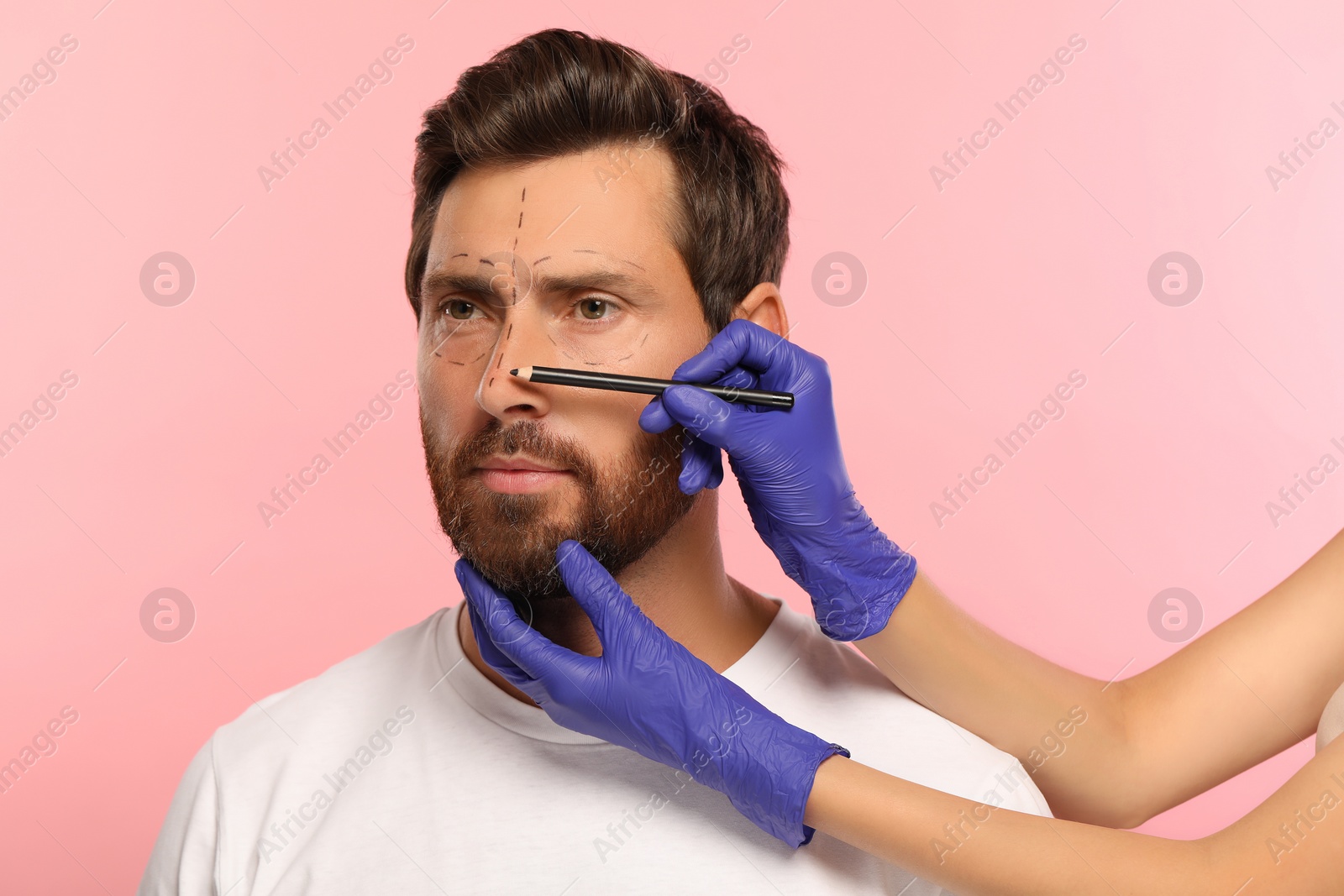 Photo of Doctor with pencil preparing patient for cosmetic surgery operation on pink background