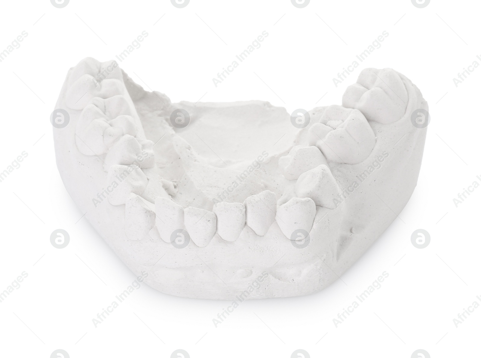 Photo of Dental model with gum isolated on white. Cast of teeth