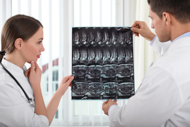 Orthopedists examining X-ray picture near window in office