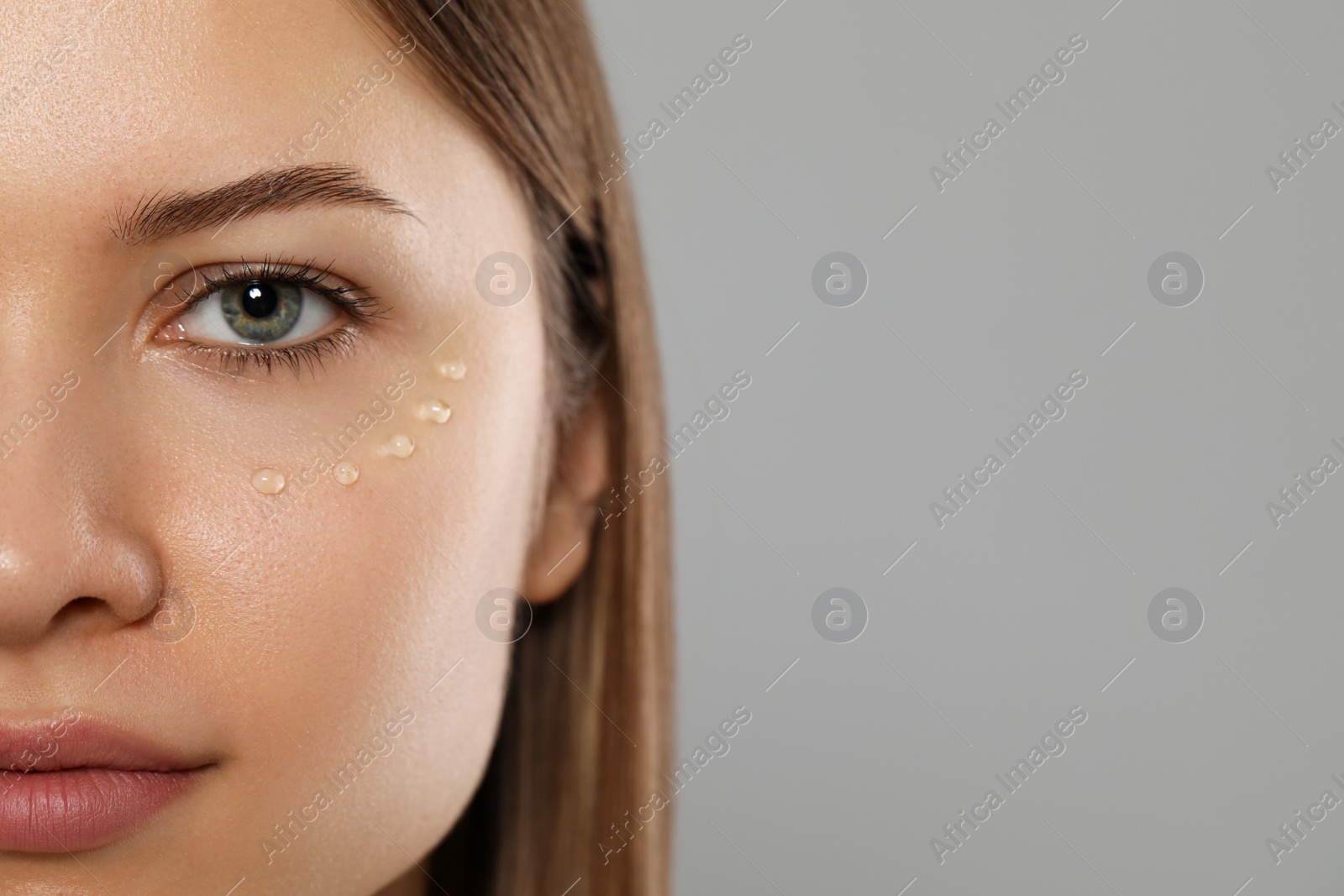 Photo of Young woman with cream around eye on light grey background, closeup. Space for text