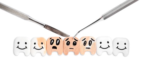 Photo of Decorative healthy and damaged teeth with dentist tools on white background, top view