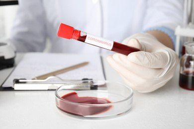 Photo of Scientist holding test tube with blood sample and label CORONA VIRUS in laboratory, closeup
