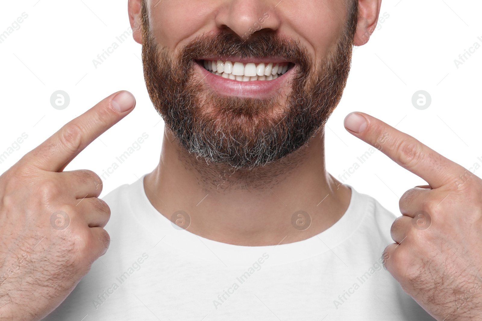 Photo of Man showing healthy gums on white background, closeup