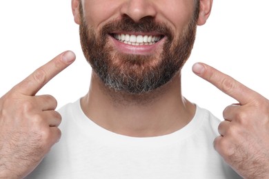 Photo of Man showing healthy gums on white background, closeup