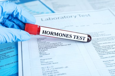 Hormones test. Scientist holding sample tube with blood against laboratory form, closeup