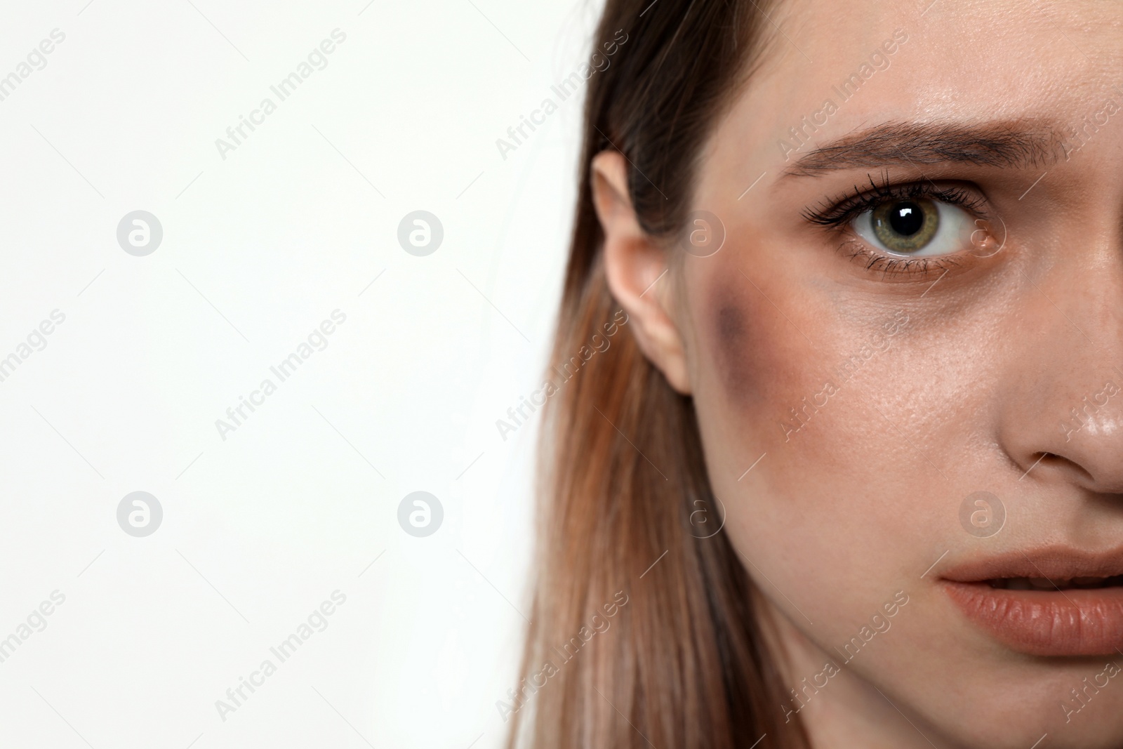 Photo of Abused young woman on light background, closeup. Stop violence