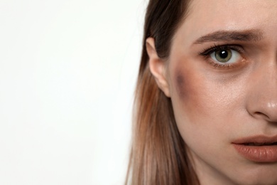 Abused young woman on light background, closeup. Stop violence