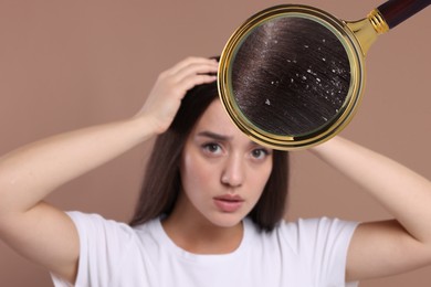 Woman suffering from dandruff on pale brown background. View through magnifying glass on hair with flakes