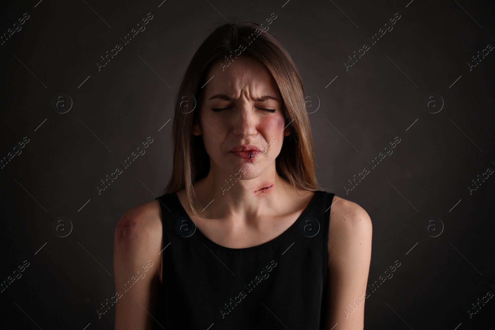 Photo of Woman with facial injuries on black background. Domestic violence victim