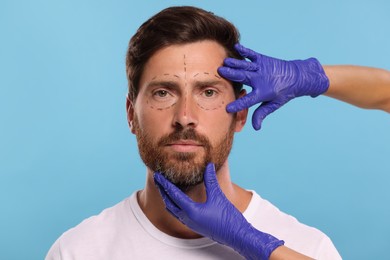 Doctor checking marks on man's face for cosmetic surgery operation against light blue background