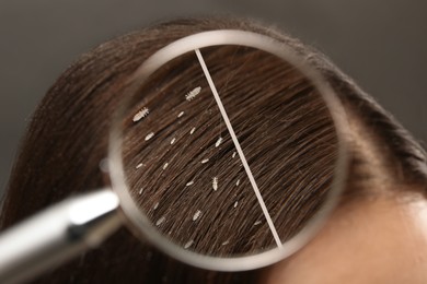 Image of Collage showing woman's hair before and after lice treatment on grey background, closeup. View on parasitic insect through magnifying glass. Suffering from pediculosis