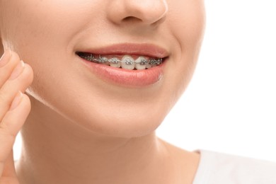 Photo of Smiling woman with dental braces on white background, closeup