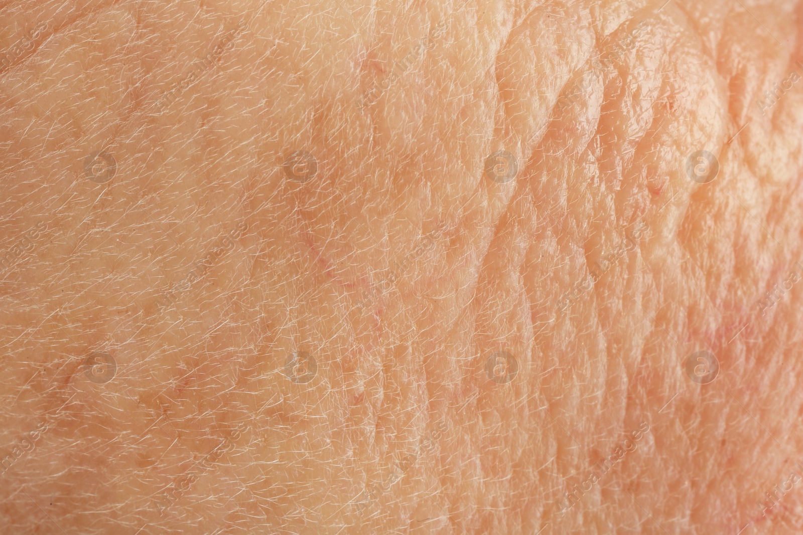 Photo of Texture of human skin with wrinkles as background, macro view