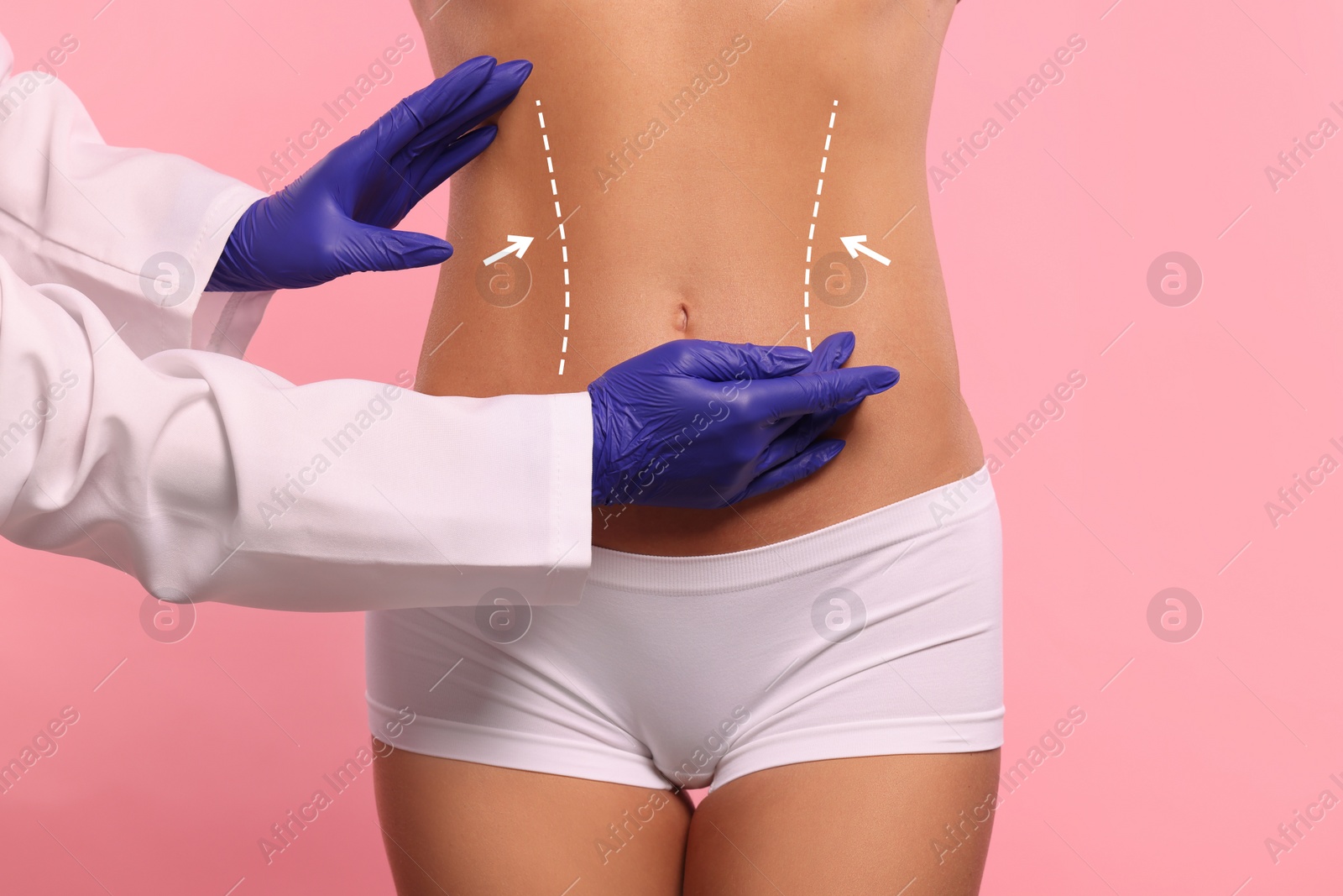 Image of Doctor and patient preparing for cosmetic surgery, pink background. Woman with markings on her abdomen, closeup