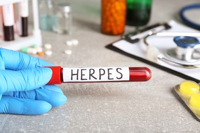 Photo of Doctor in glove holding test tube with word Herpes at light grey table, closeup