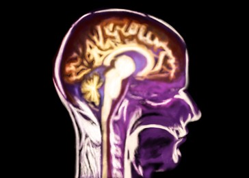 Illustration of Scan of human brain area on black background, illustration