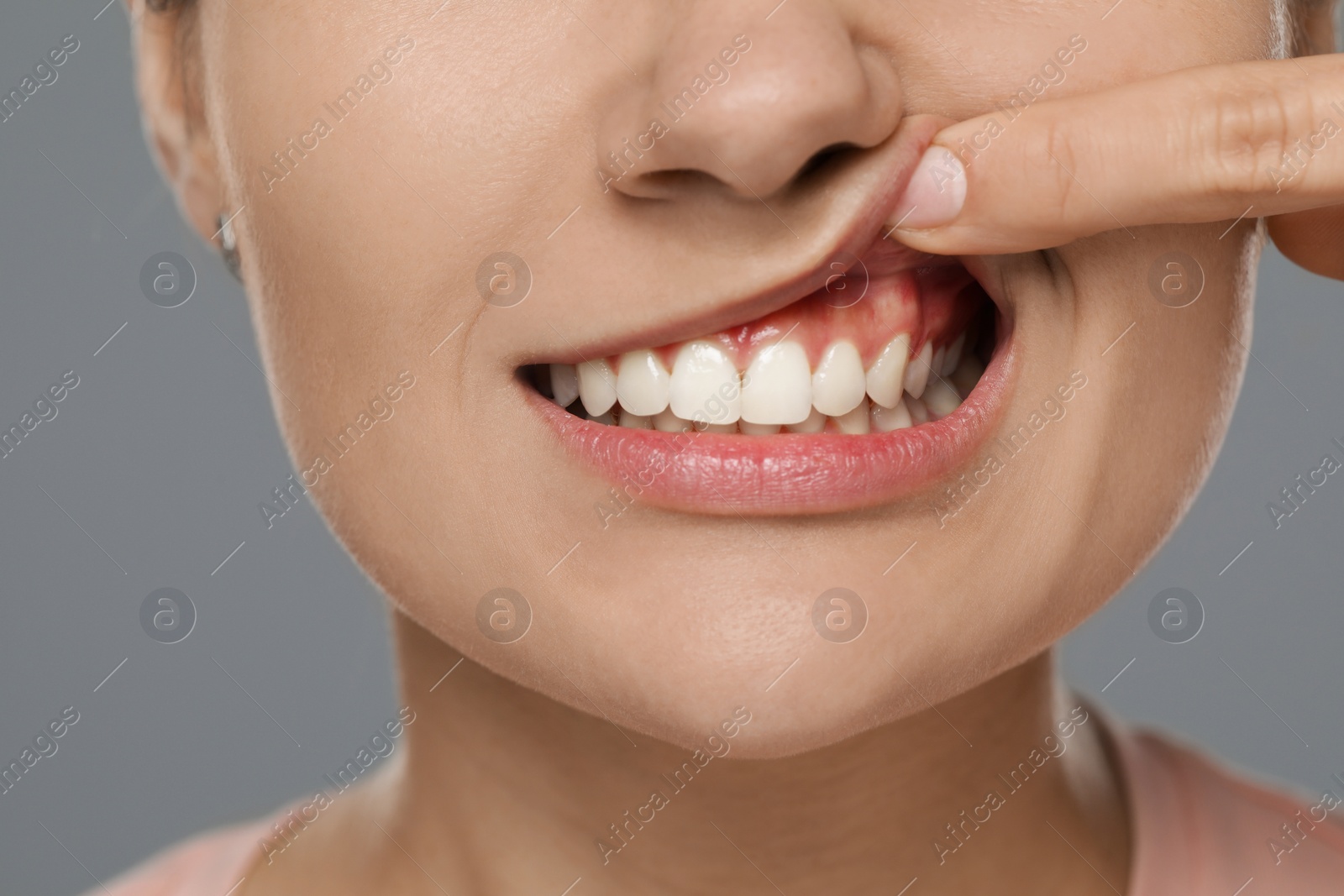 Photo of Woman showing healthy gums on gray background, closeup