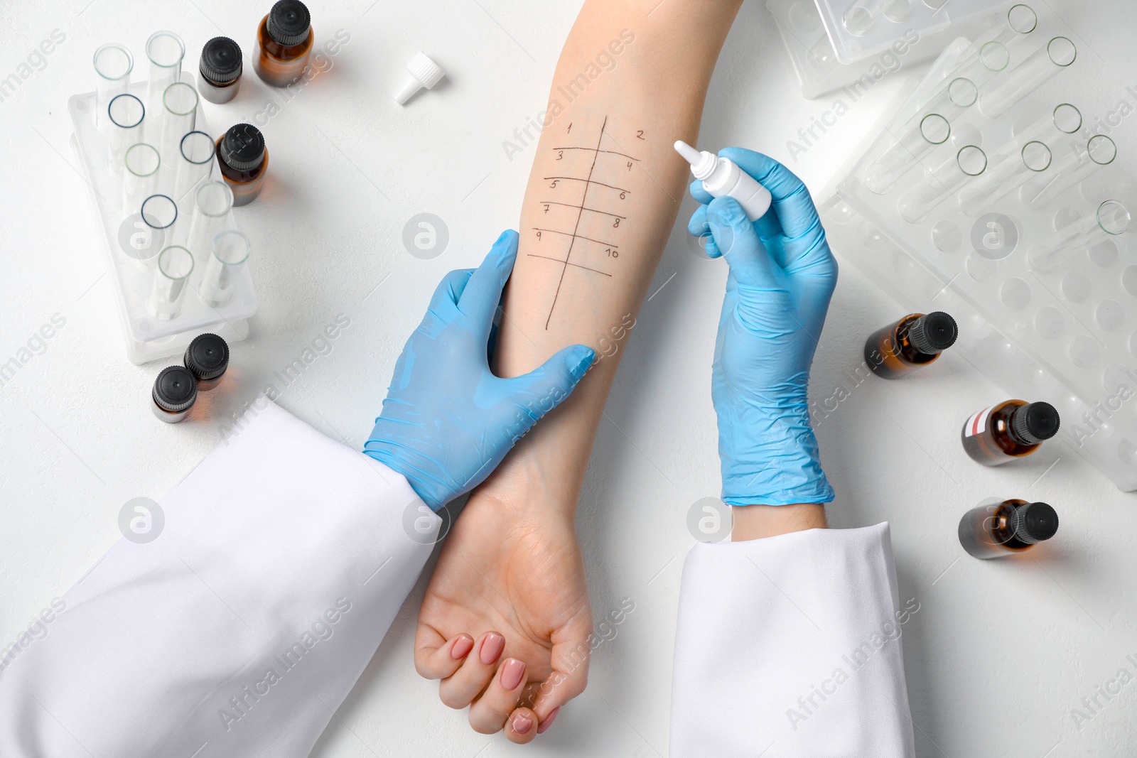 Photo of Doctor doing skin allergy test at light table, top view