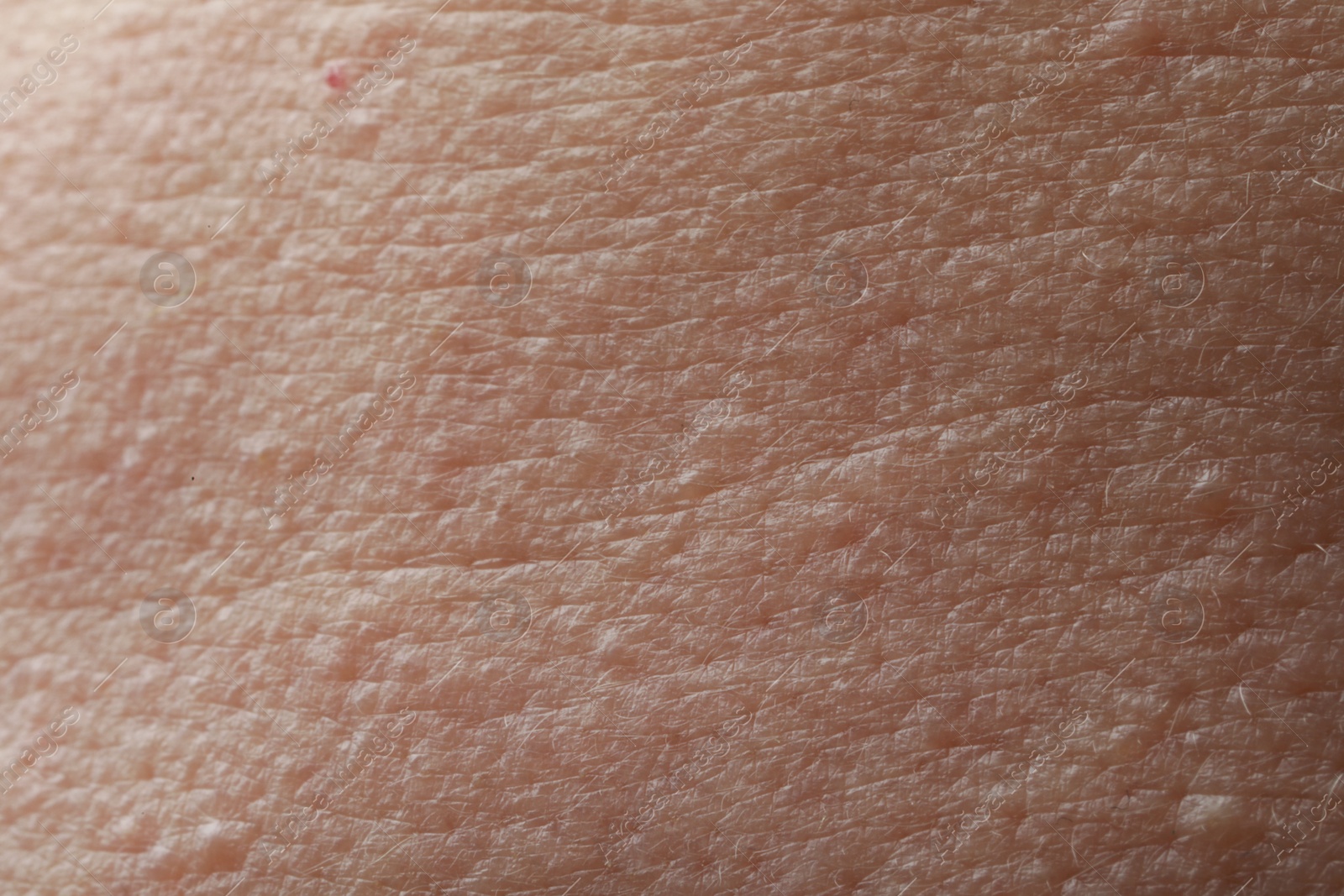 Photo of Closeup view of human skin as background