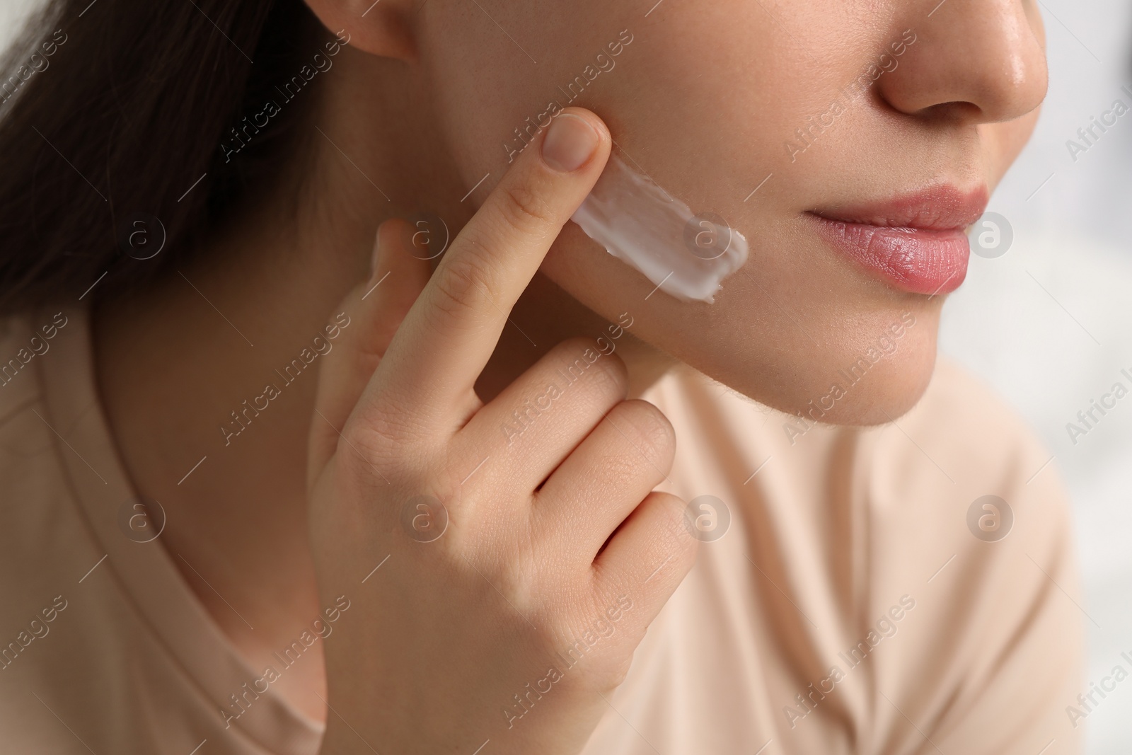 Photo of Young woman with dry skin applying cream onto her face on blurred background, closeup