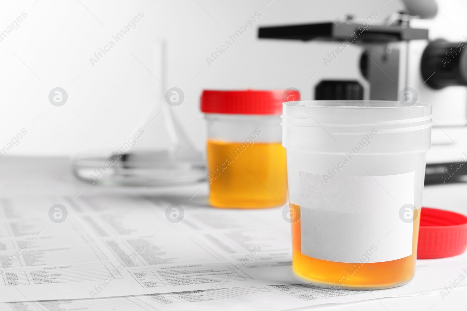 Photo of Container with urine sample on table in laboratory, space for text. Specimen collection