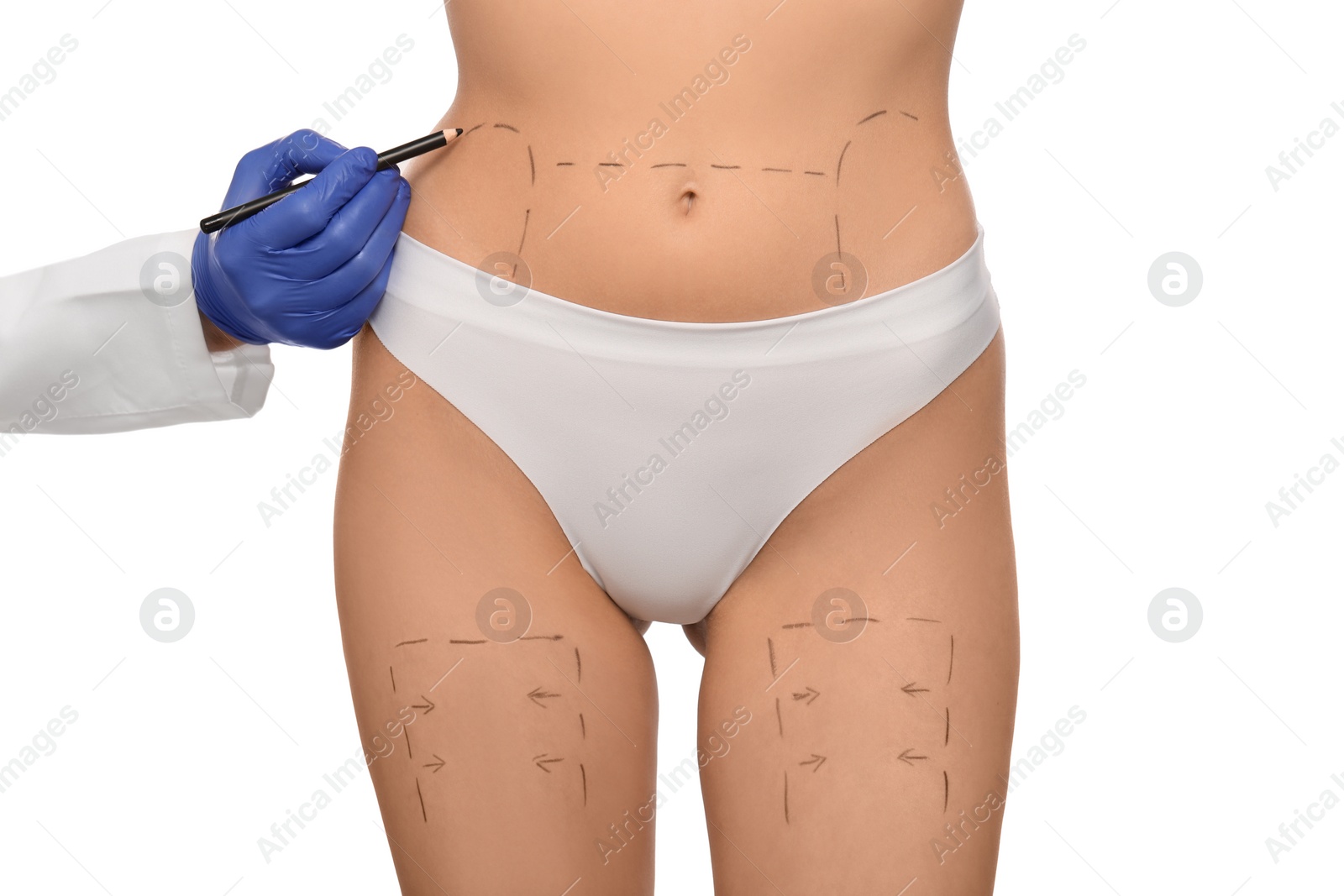 Photo of Doctor with pencil preparing patient for cosmetic surgery operation on white background, closeup