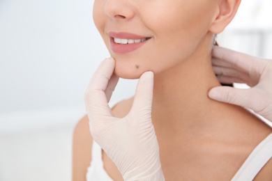 Dermatologist examining patient's birthmark in clinic, closeup