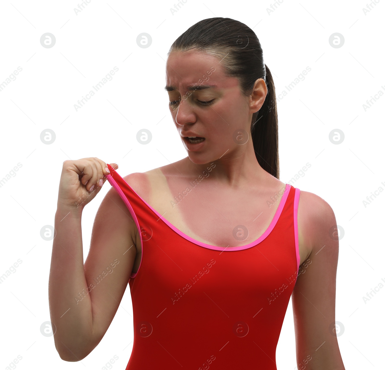 Photo of Woman with sunburned skin on white background