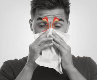 Man suffering from runny nose as allergy symptom. Sinuses illustration on face
